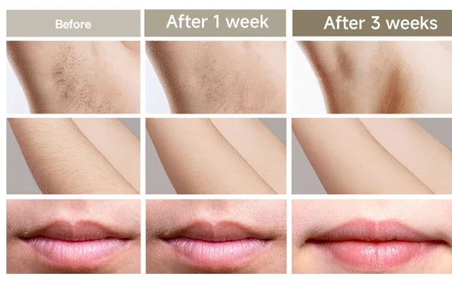 Depilador elétrico à laser, IPL, permanente, portátil, pulso rápido