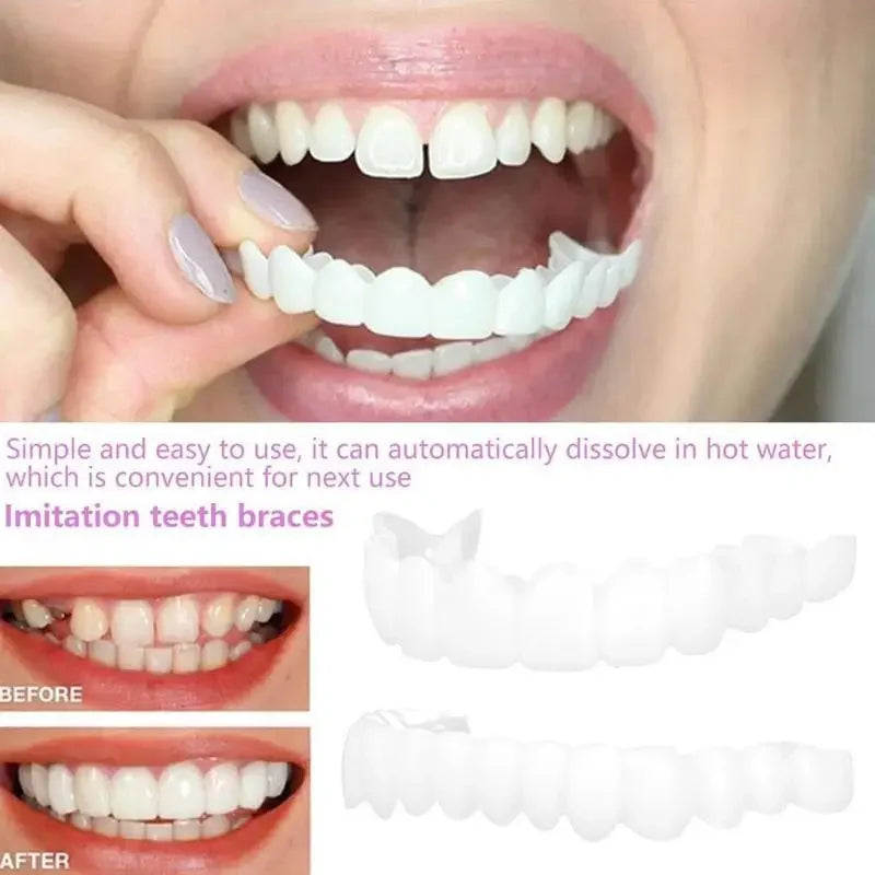 Facetas para Encaixar nos Dentes - Sorriso Brilhante
