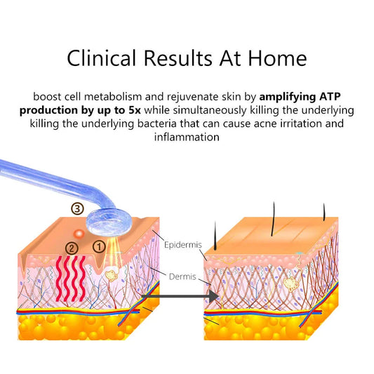 ferramentas faciais para cuidados com a pele mostrando corte da pele antes e depois e aumento de ATP com ação antibacteriana