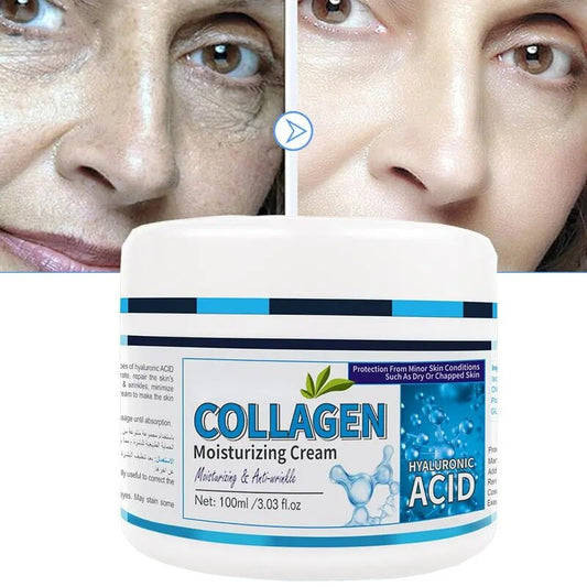 Creme de tratamento da pele facial YRFKT com ácido hialurônico, creme anti-envelhecimento eficaz para hidratação profunda