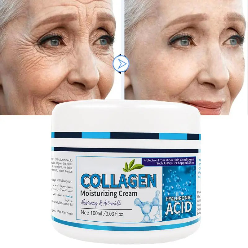 Creme de tratamento YRFKT com colágeno e ácido hialurônico, creme anti-envelhecimento eficaz para hidratação da pele