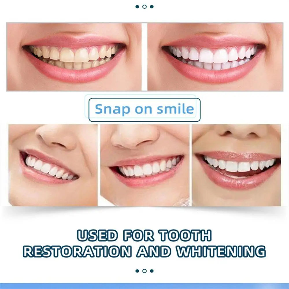 Facetas dentárias CRAZY LIFE mostrando sorrisos antes e depois folheados SnapOn para dentes para restauração e branqueamento