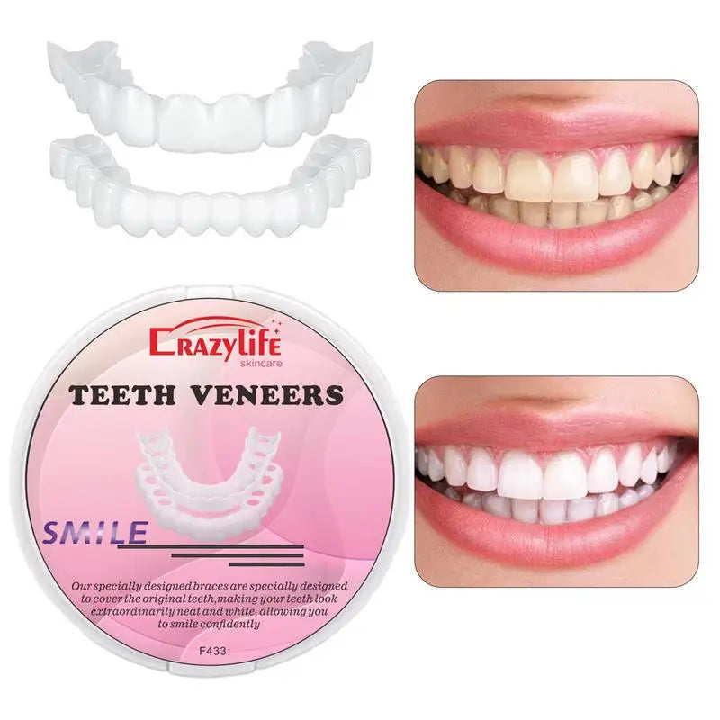 Facetas dentárias CRAZY LIFE com estojo e imagens antes e depois mostrando folheados SnapOn para dentes