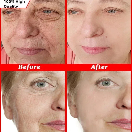 Antes e depois do uso do creme facial removedor de rugas, mostrando resultados visíveis na pele.