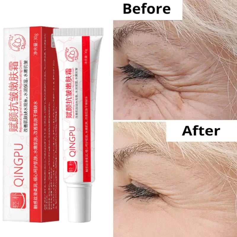 Creme facial removedor de rugas para tratar e suavizar marcas ao redor dos olhos, antes e depois do uso