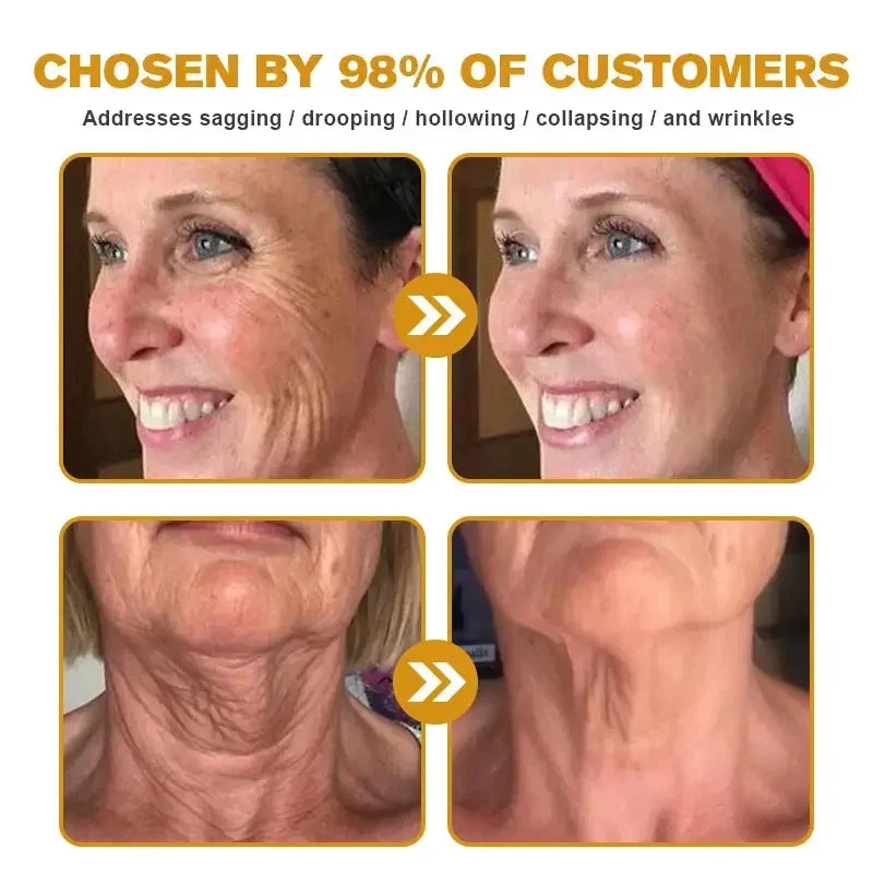 Antes e depois do creme facial removedor de rugas mostrando resultados visíveis na pele