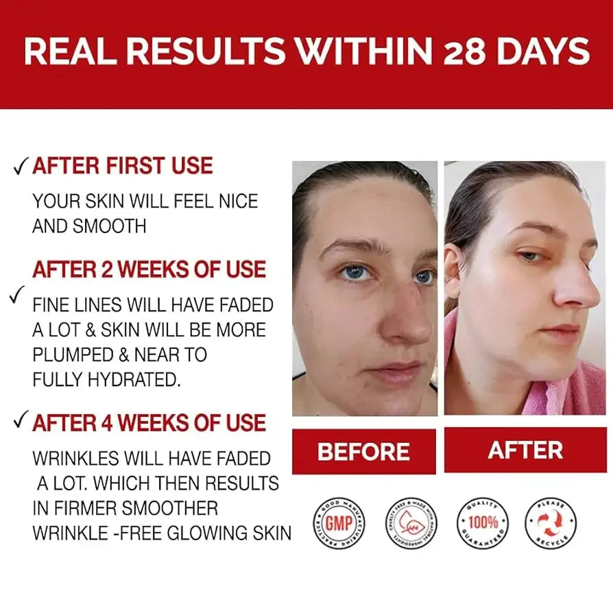 Antes e depois de uso de creme facial removedor de rugas mostrando resultados visíveis em 28 dias