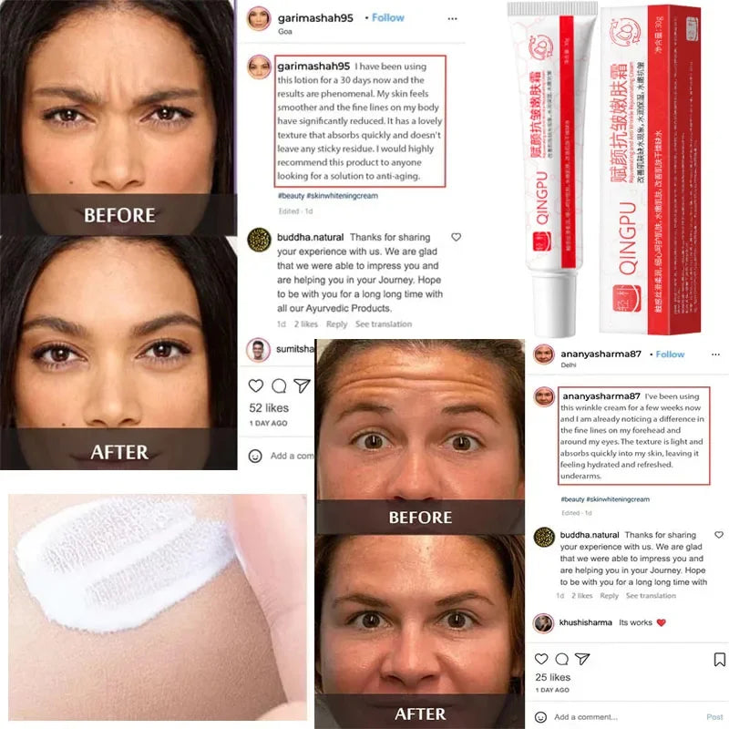 Creme facial removedor de rugas com efeito antes e depois em diferentes tipos de pele