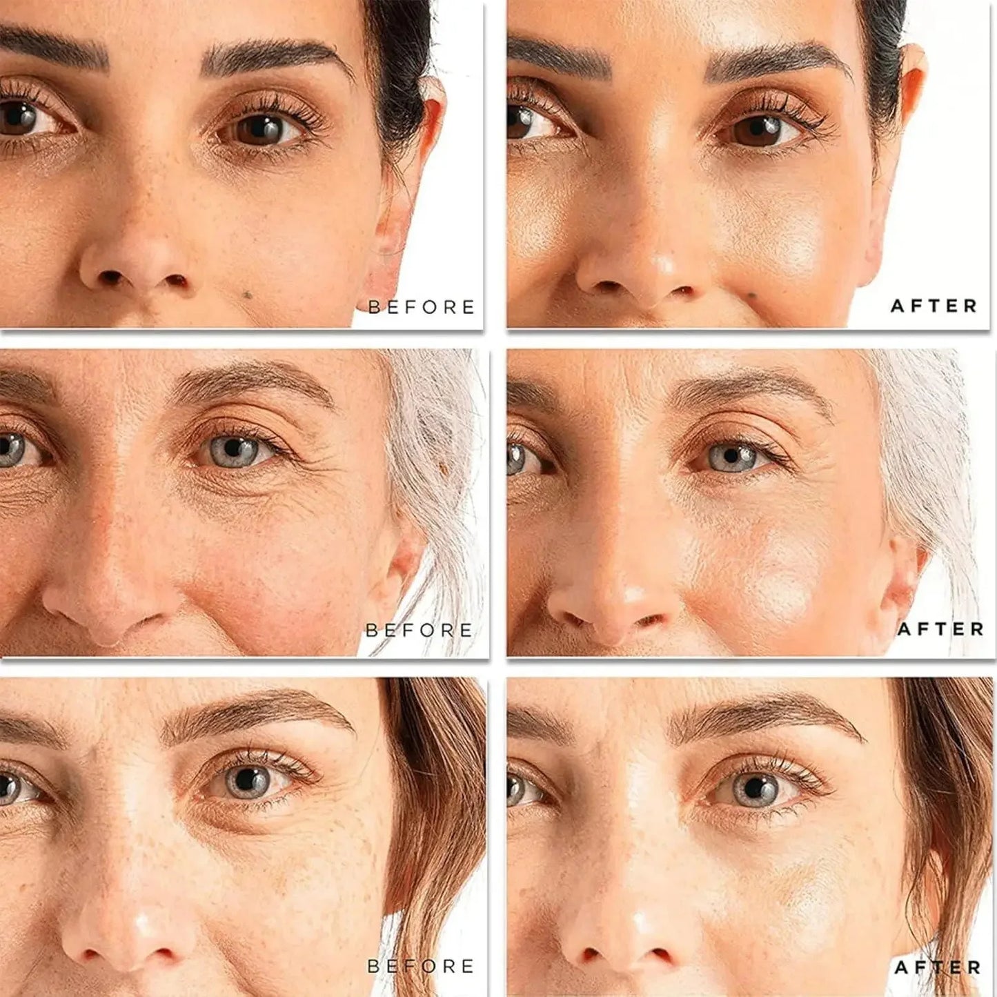 Resultados de creme facial removedor de rugas em antes e depois em pele facial saudável