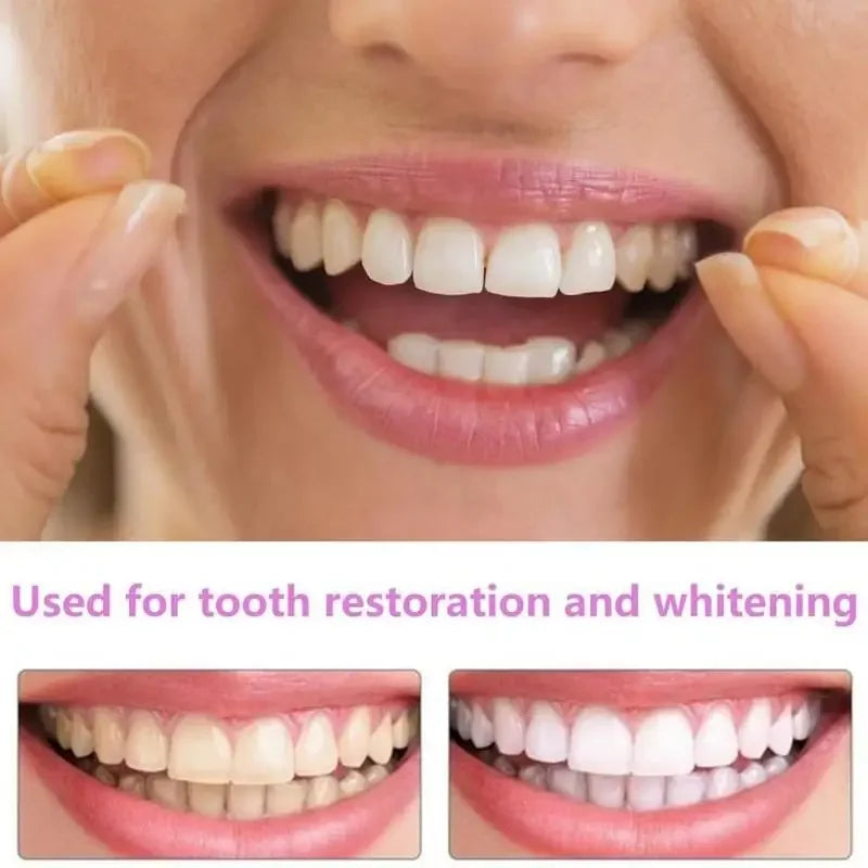 Mulher sorrindo enquanto segura facetas para encaixar nos dentes, mostrando o efeito de clareamento.