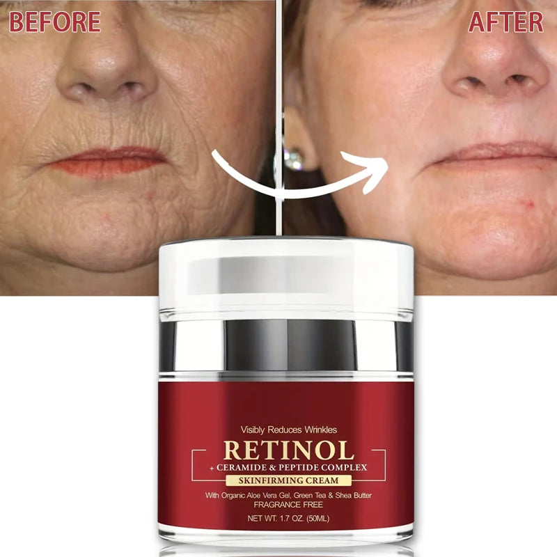 Creme de tratamento da pele facial ANYIF com retinol, ideal como hidratante facial firmador para reduzir rugas