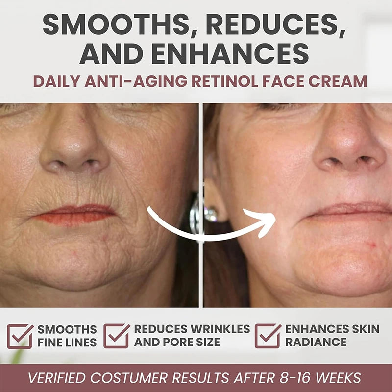 Creme de tratamento da pele facial ANYIF hidratante facial firmador com resultados visíveis em 8 a 16 semanas