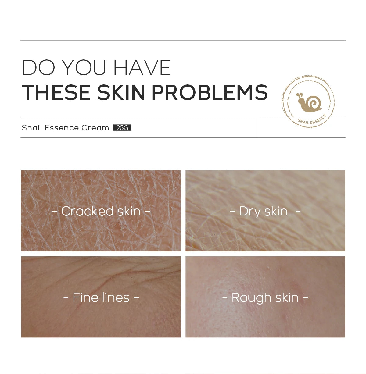 Creme de tratamento facial LAIKOU para hidratar pele rosto danificada com extrato de caracol