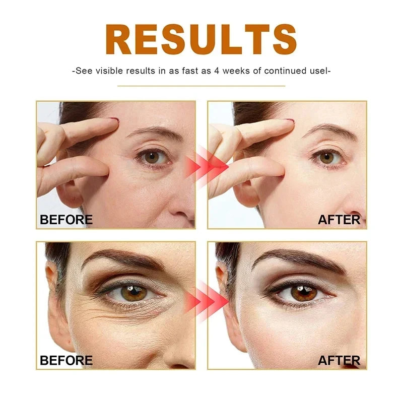 Resultados de uso do soro antienvelhecimento facial EELHOE mostrando antes e depois em 4 semanas