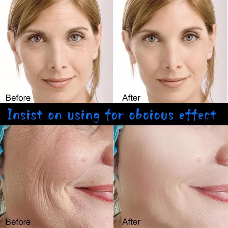 Soro facial antienvelhecimento LANBENA com resultados visíveis antes e depois em uma modelo