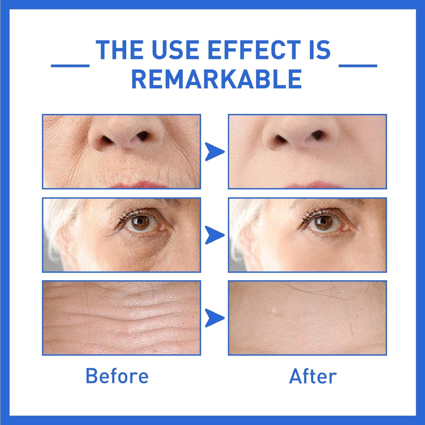 Resultados impressionantes do soro facial antienvelhecimento LANBENA em antes e depois do uso