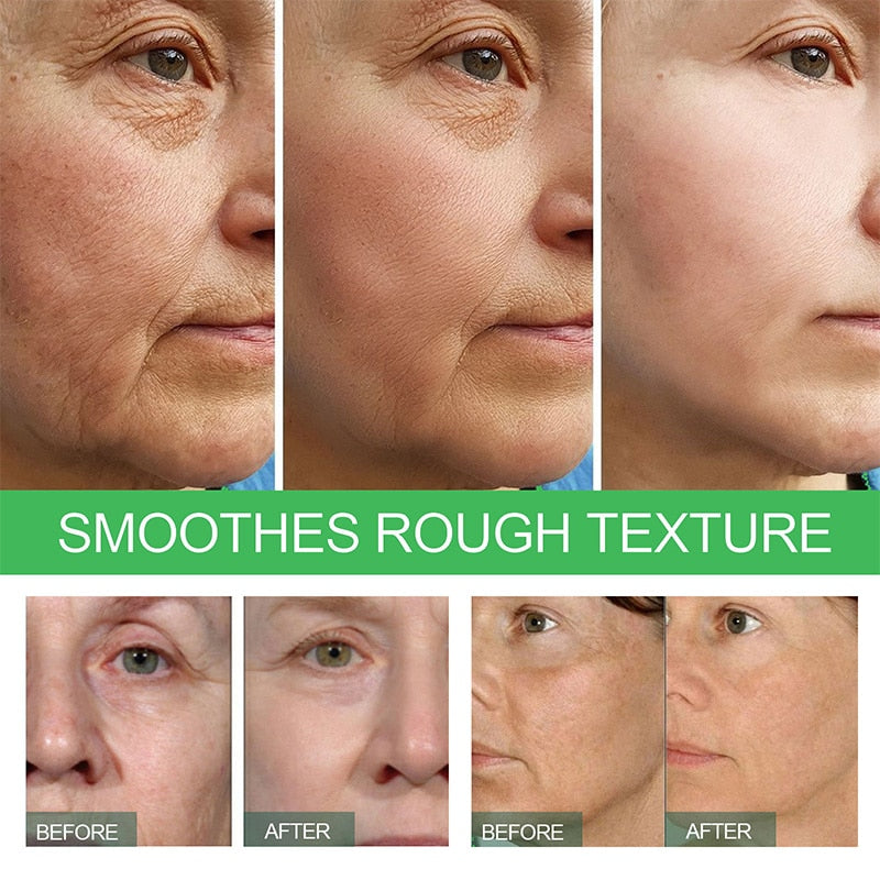 Kit de limpeza e tratamento facial EELHOE para tratamento para linhas finas com resultados visíveis antes e depois