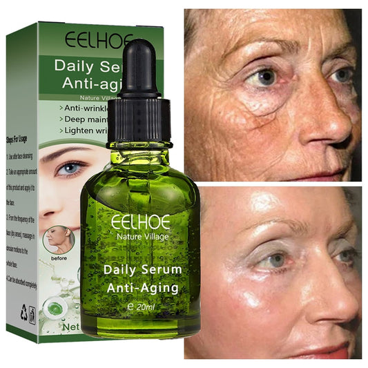 Sérum facial anti-idade EELHOE de 20ml com efeito hidratante e anti-rugas antes e depois do uso