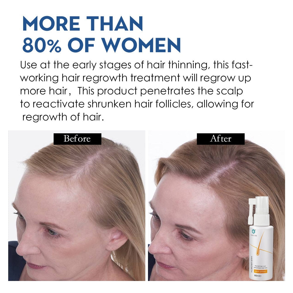 Tratamento de regrowth para cabelos HAIRCUBE com resultados visíveis antes e depois na revitalização capilar
