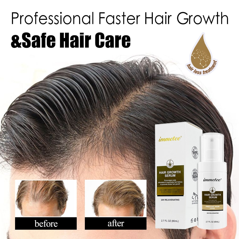 Tratamento anti-queda cabelo IMMETEE com frasco para crescimento capilar e resultados antes e depois