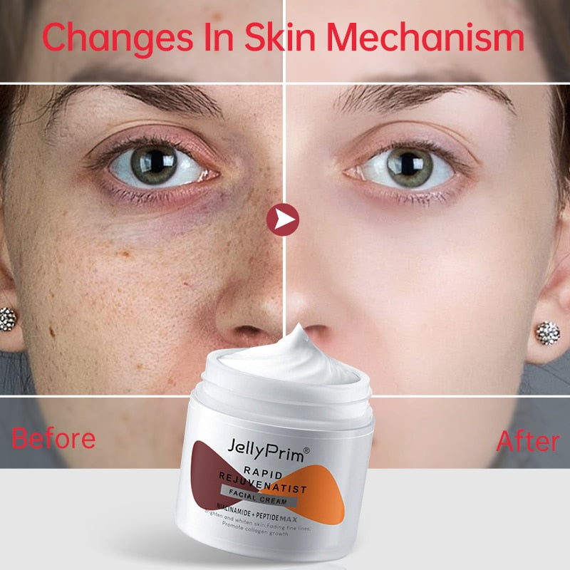 Kit de tratamento facial rejuvenescedor JOYPRETTYIN com creme rejuvenescedor antirrugas para revitalizar a pele
