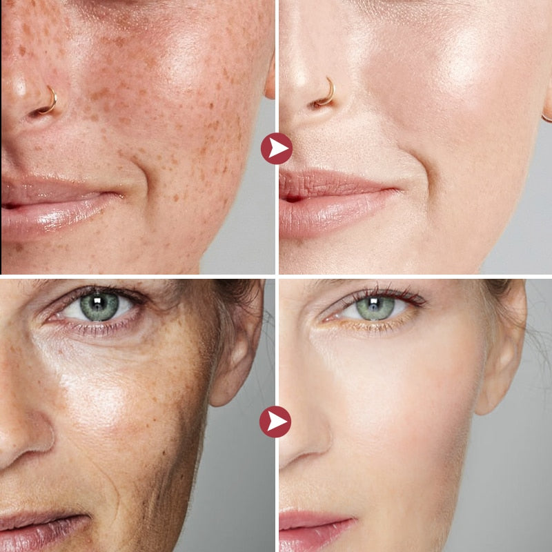 Anรกlise de pele com antes e depois usando creme rejuvenescedor antirrugas JOYPRETTYIN para uma pele mais jovem