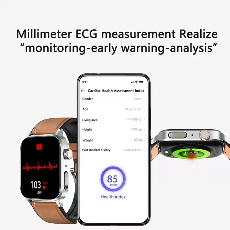 Smartwatch oxigênio no sangue da PLUXURY com monitoramento de ECG e análise de saúde no pulso