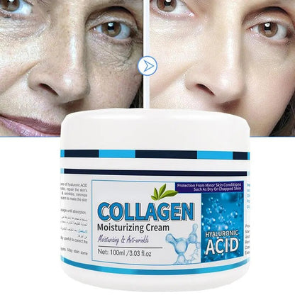 Creme de Tratamento da Pele Facial com Colágeno e Ácido HIALURÔNICO, Cuidados Faciais, Antirrugas, Hidratante, Creme Facial ANTI Envelhecimento