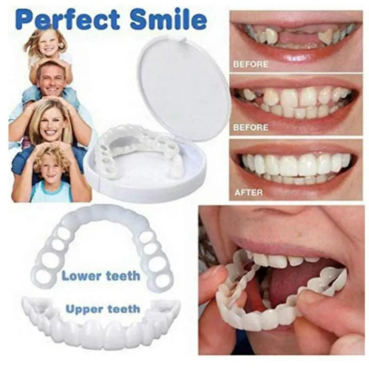 Facetas dentárias CRAZY LIFE mostrando folheados SnapOn para dentes superiores e inferiores com estojo e resultado antes e depois