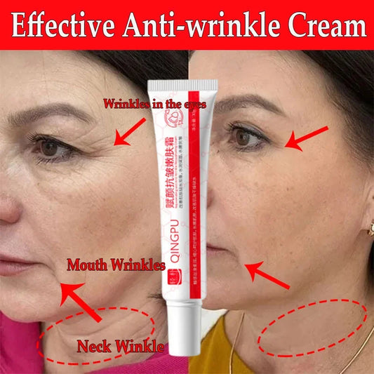 Creme facial removedor de rugas em destaque, mostrando benefícios para a pele ao redor dos olhos e boca