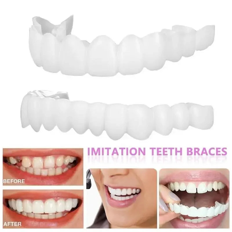 Facetas para encaixar nos dentes em comparação com dentes brancos naturais antes e depois do uso