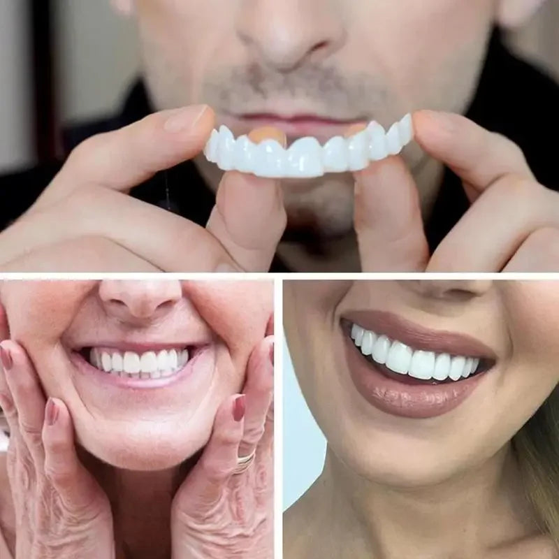 Facetas para encaixar nos dentes apresentadas por pessoas com sorrisos brilhantes e saudáveis