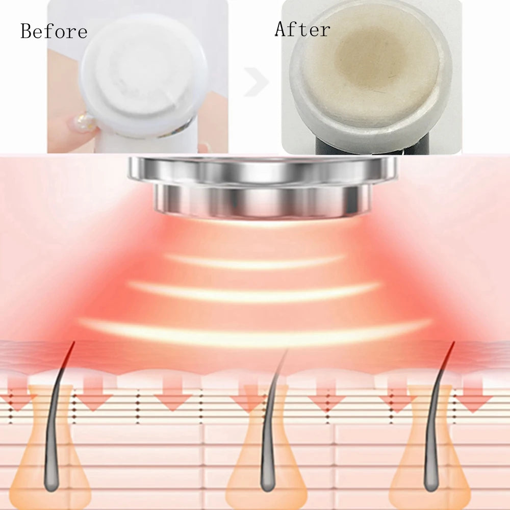 Massageador facial GENNADIYA para rejuvenescimento facial LED com tecnologia avançada e resultados visíveis