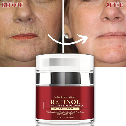 Creme de tratamento da pele facial ANYIF com retinol, ideal como hidratante facial firmador para reduzir rugas