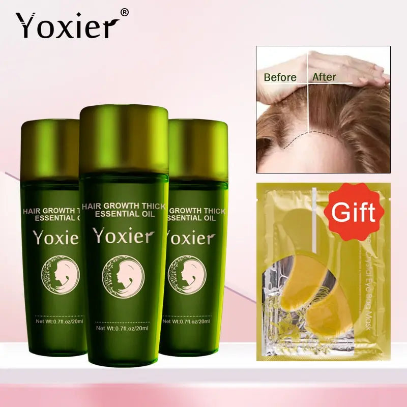 Yoxier 3 Pcs Óleo de Essência de Crescimento de Cabelo Extrato Eficaz Anti Nutrir Tratamento de Raízes de Cabelo Prevenindo a Queda de Cabelo Produtos de Cuidados com o Cabelo Yoxier